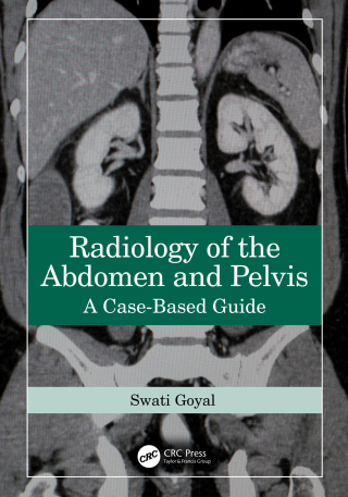 Radiology of the Abdomen and Pelvis