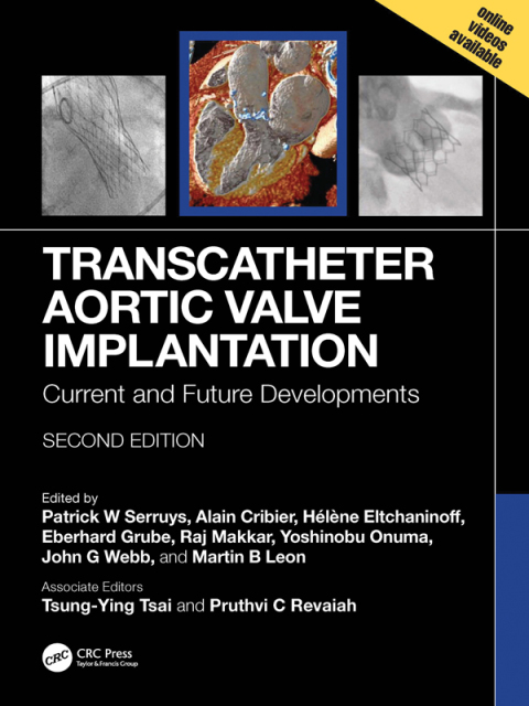 Cover image for book Transcatheter Aortic Valve Implantation