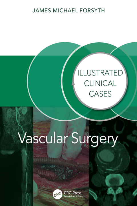 Vascular Surgery: Illustrated Clinical Cases 