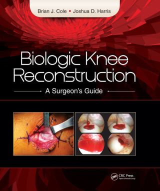 Biologic Knee Reconstruction