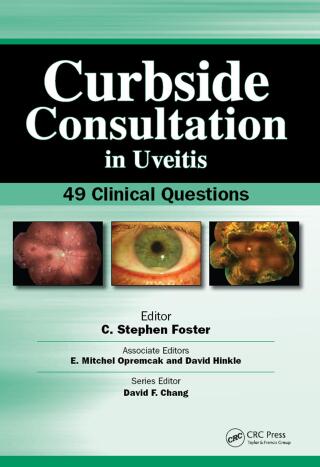 Curbside Consultation in Uveitis