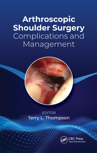 Arthroscopic Shoulder Surgery