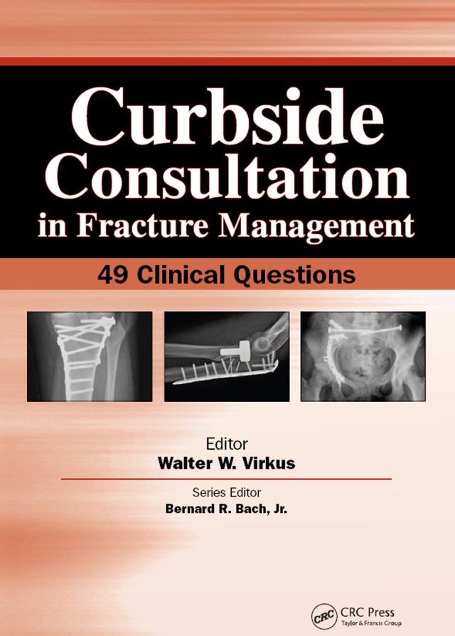 Curbside Consultation in Fracture Management