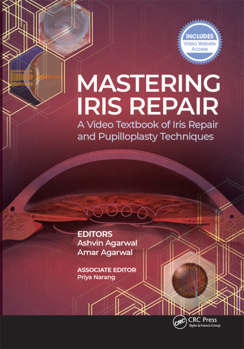 Mastering Iris Repair 