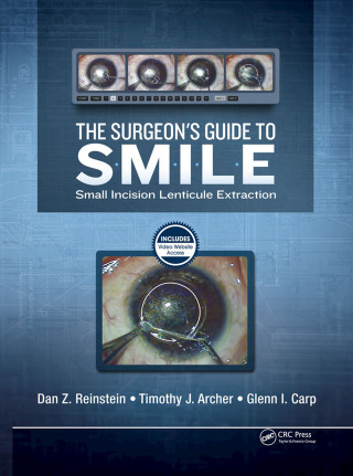 The Surgeon’s Guide to SMILE
