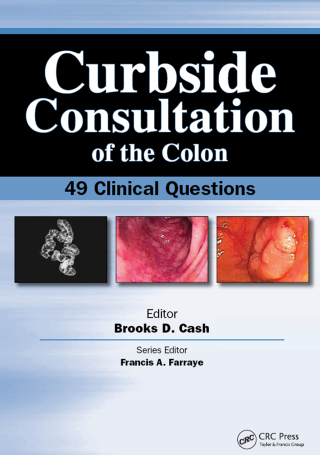 Curbside Consultation of the Colon