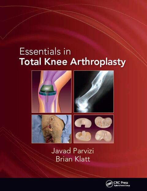 Essentials in Total Knee Arthroplasty 