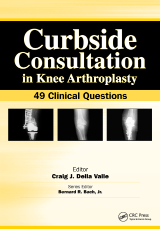 Curbside Consultation in Knee Arthroplasty