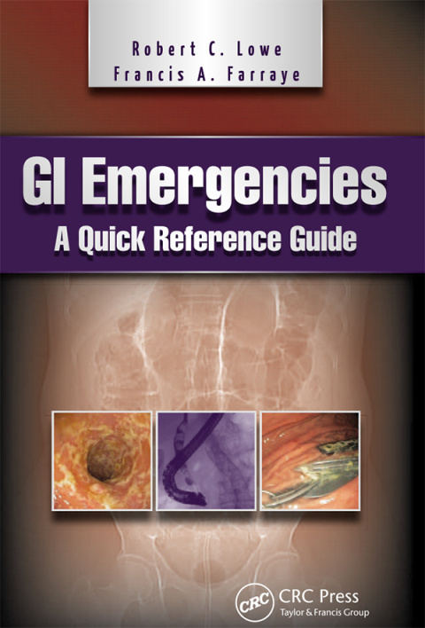 GI Emergencies 