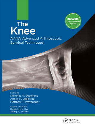 The Knee