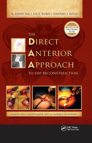 The Direct Anterior Approach to Hip Reconstruction