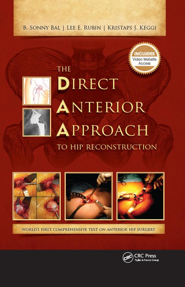 The Direct Anterior Approach to Hip Reconstruction