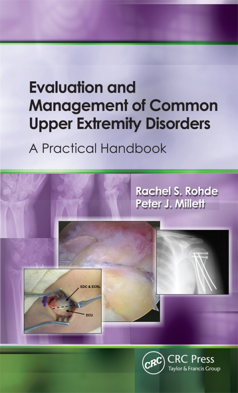 Evaluation and Management of Common Upper Extremity Disorders 