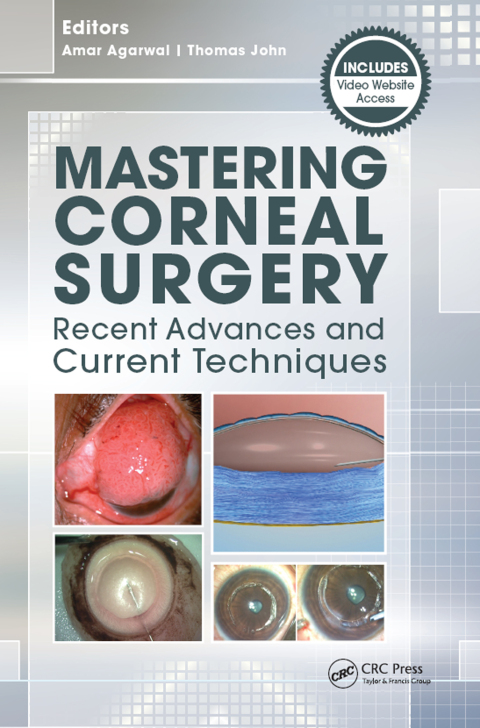 Mastering Corneal Surgery 