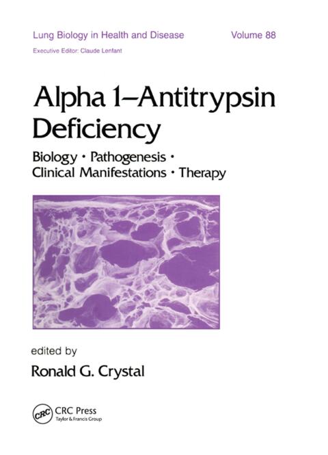 Cover image for book Alpha 1 - Antitrypsin Deficiency