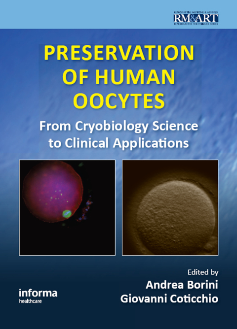 Cover image for book Preservation of Human Oocytes
