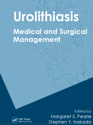 Urolithiasis