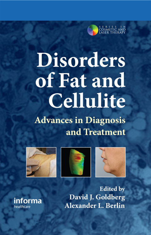 Cover image for book Disorders of Fat and Cellulite