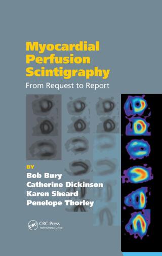 Myocardial Perfusion Scintigraphy