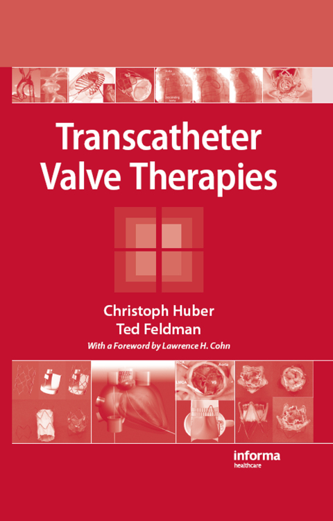Transcatheter Valve Therapies 