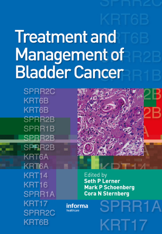 Treatment and Management of Bladder Cancer