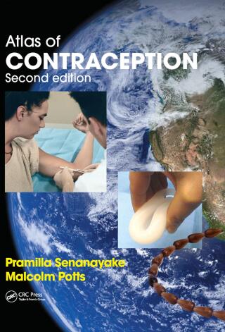 Atlas of Contraception