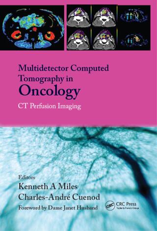 Multi-Detector Computed Tomography in Oncology