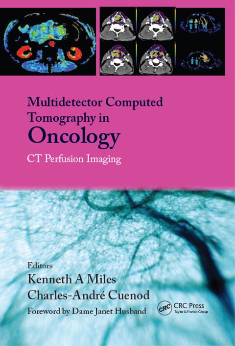 Cover image for book Multi-Detector Computed Tomography in Oncology