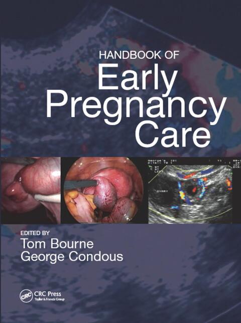 Cover image for book Handbook of Early Pregnancy Care