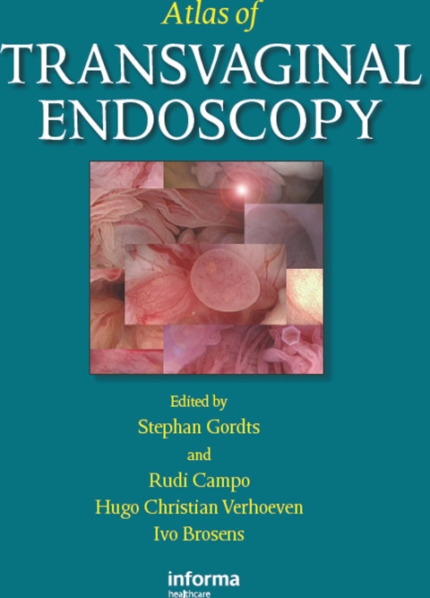 Cover image for book Atlas of Transvaginal Endoscopy