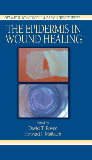The Epidermis in Wound Healing