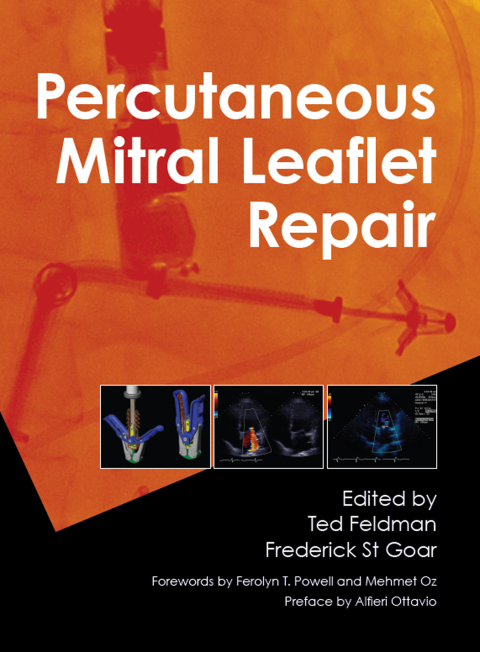Cover image for book Percutaneous Mitral Leaflet Repair