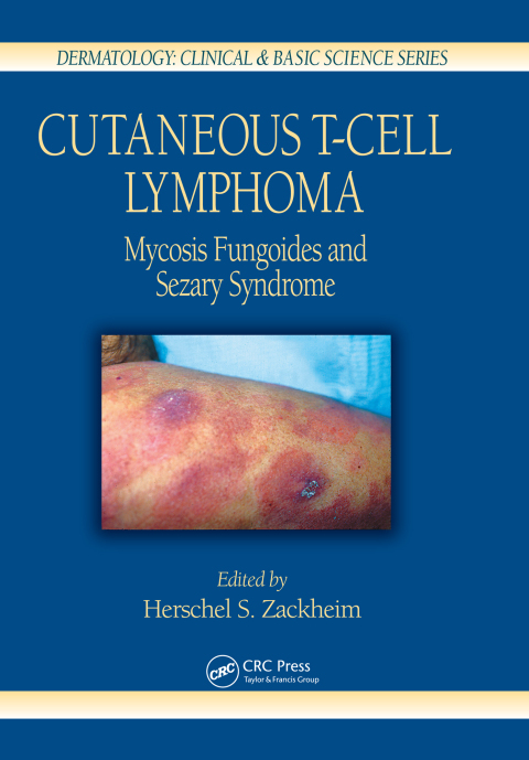 Cover image for book Cutaneous T-Cell Lymphoma
