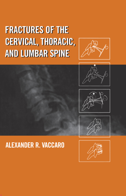 Fractures of the Cervical, Thoracic, and Lumbar Spine 