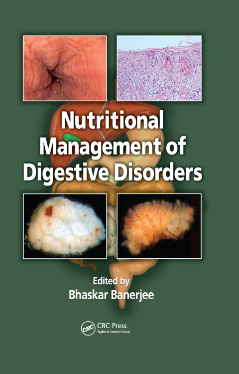 Cover image for book Nutritional Management of Digestive Disorders