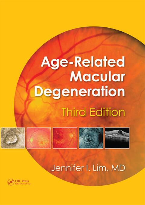 Cover image for book Age-Related Macular Degeneration, Third Edition