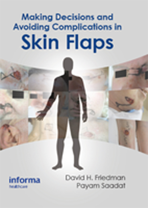 Cover image for book Making Decisions and Avoiding Complications in Skin Flaps