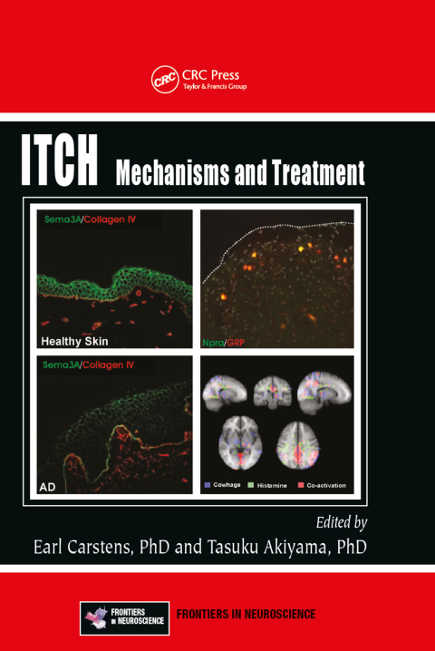 Cover image for book Itch