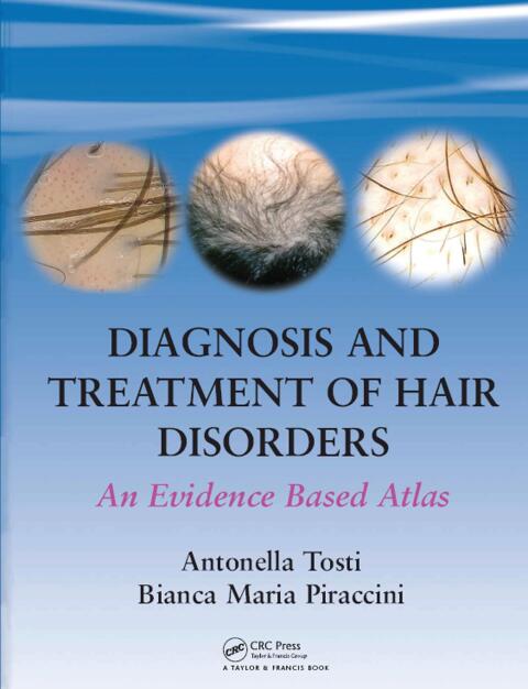 Diagnosis and Treatment of Hair Disorders 