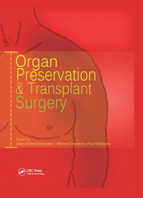 Cover image for book Organ Preservation and Transplant Surgery
