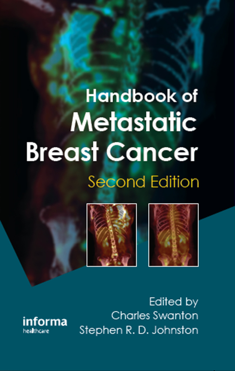 Cover image for book Handbook of Metastatic Breast Cancer