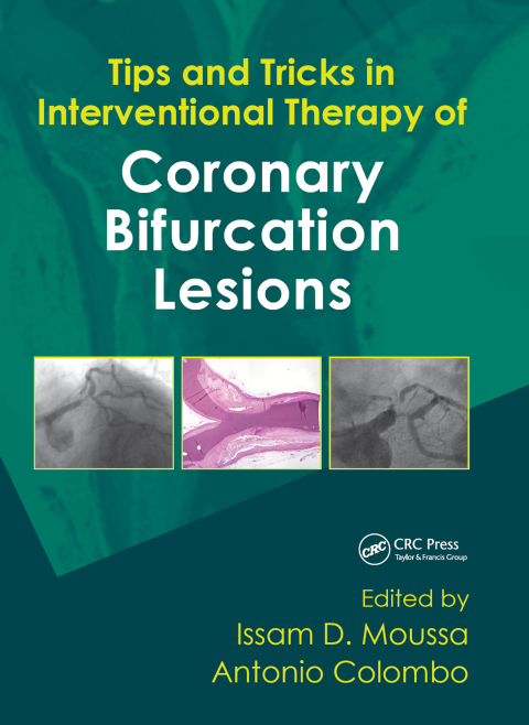 Cover image for book Tips and Tricks in Interventional Therapy of Coronary Bifurcation Lesions
