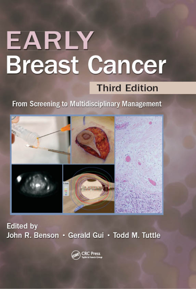 Early Breast Cancer
