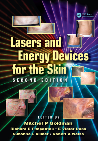 Lasers and Energy Devices for the Skin