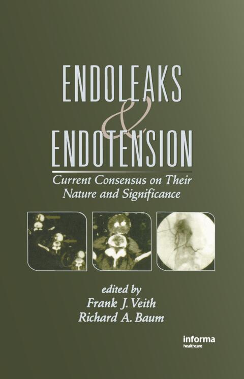 Cover image for book Endoleaks and Endotension