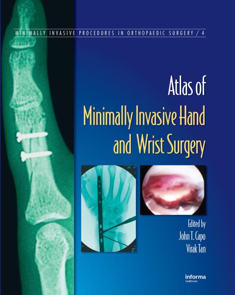 Cover image for book Atlas of Minimally Invasive Hand and Wrist Surgery