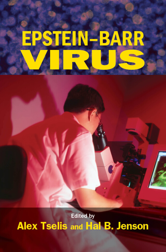 Epstein-Barr Virus