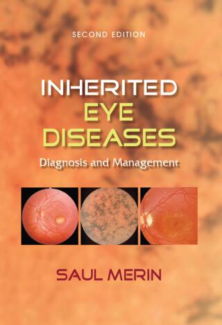 Inherited Eye Diseases