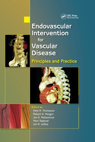 Endovascular Intervention for Vascular Disease