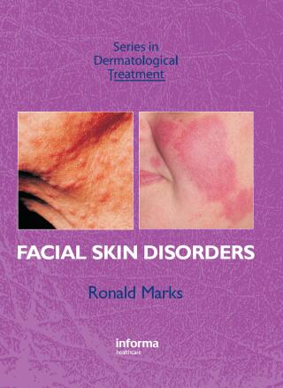 Facial Skin Disorders